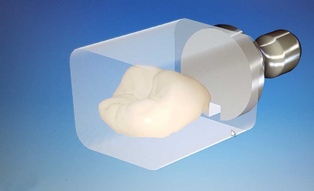 cerec